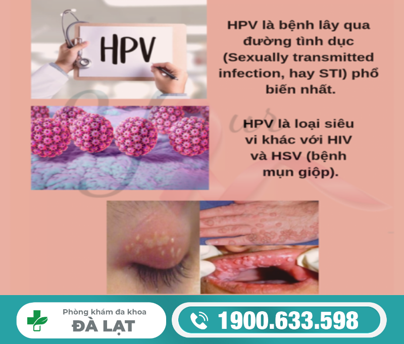 Hình ảnh minh họa